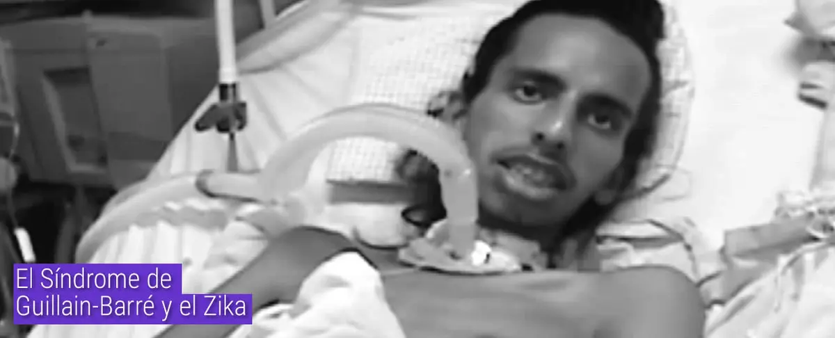 El Síndrome de Guillain-Barré y el Zika