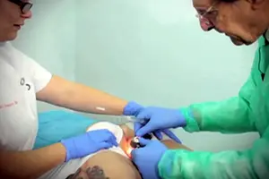 Las Hemorroides en la mujer