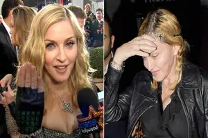 El costoso tratamiento de Madonna para quitarse las arrugas.