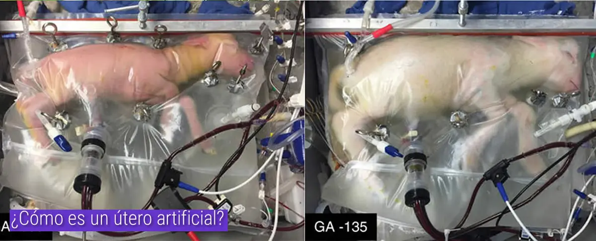 ¿Cómo es un útero artificial?