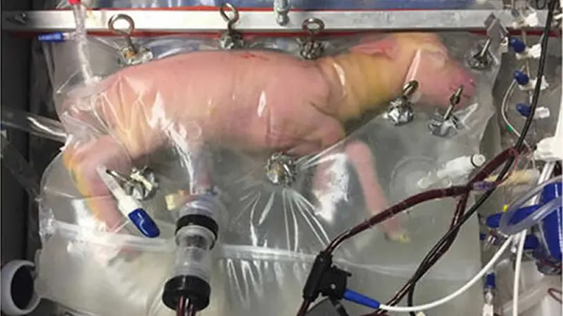 Útero artificial: Etapa inicial de gestación