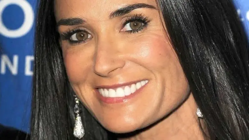 Demi Moore pierde Dientes por estress