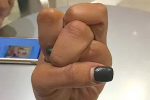 “Finger Knot” el nuevo reto que se vuelve viral en redes sociales