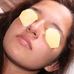 Remedios sencillos y efectivos para deshacerte de las ojeras 