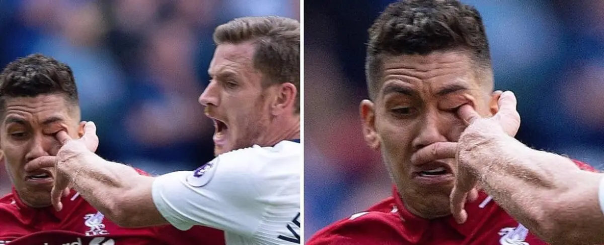 Firmino y el impactante momento en que le metieron el dedo en el ojo