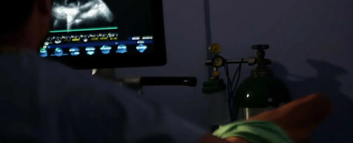 Hospital La Mascota realiza jornada para detectar enfermedades cardiovasculares