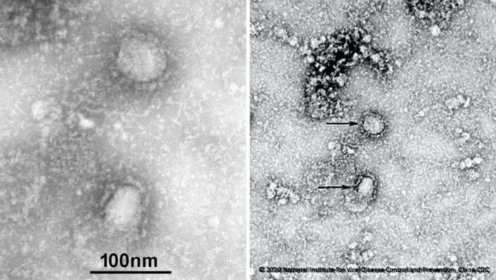 Las imágenes del mortal coronavirus son reveladas