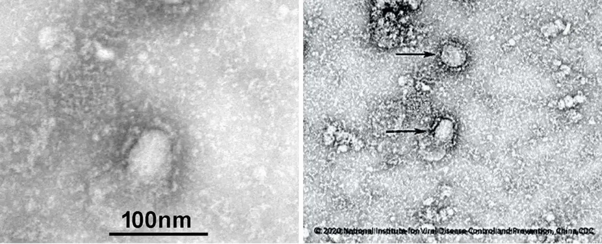 Las imágenes del mortal Coronavirus son reveladas