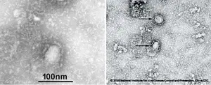 Las imágenes del mortal Coronavirus son reveladas