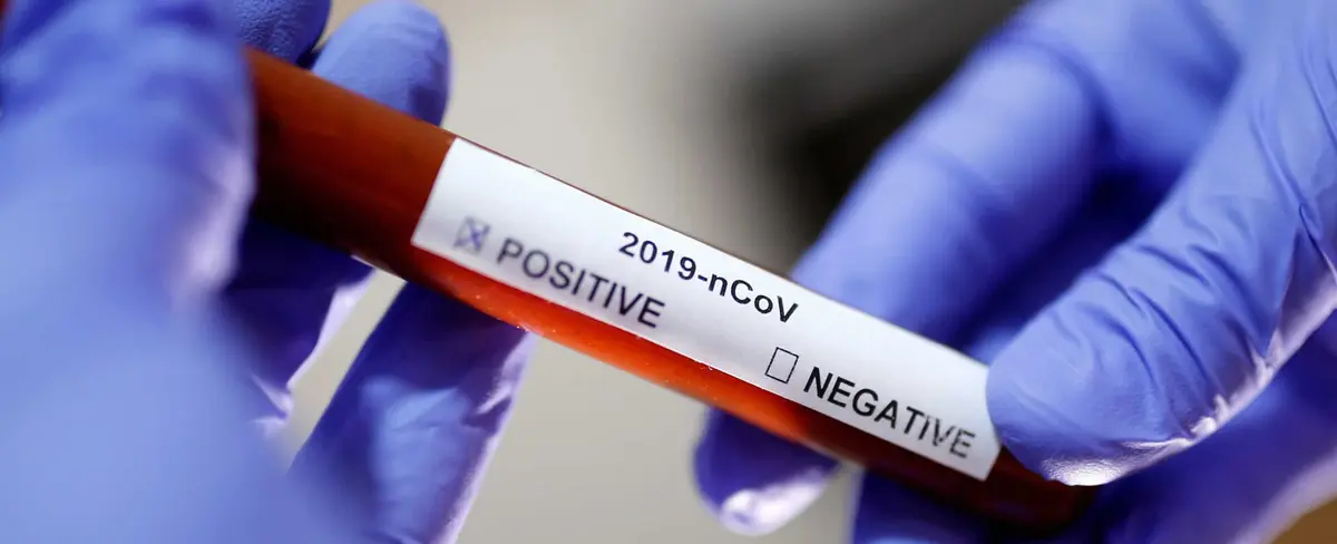 OMS declara Emergencia Sanitaria Internacional por brote del Coronavirus