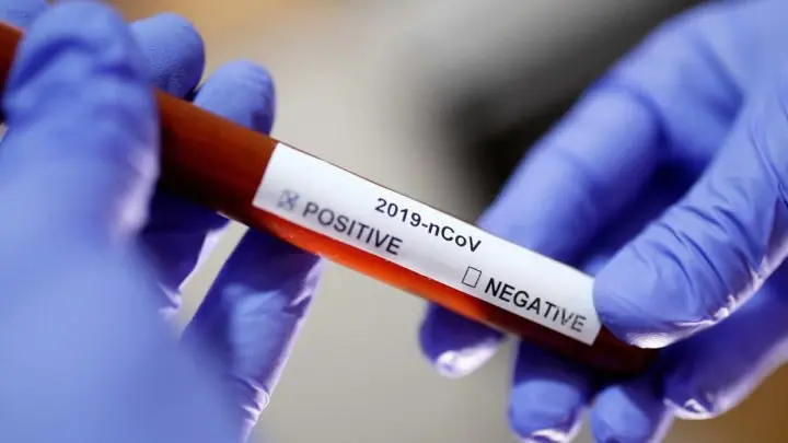 OMS declara Emergencia Sanitaria Internacional por brote de Coronavirus