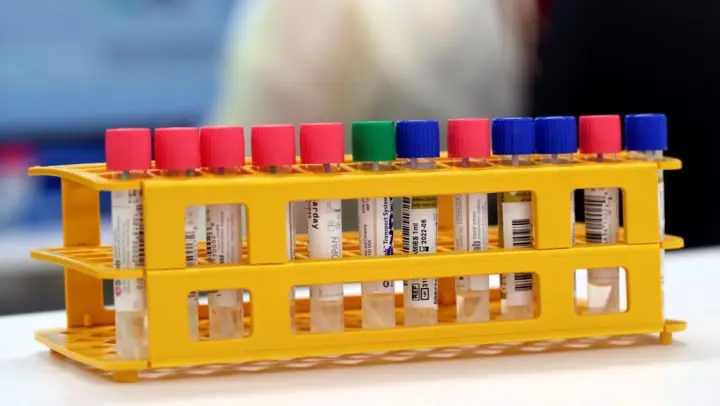 Investigaciones revelan que podrían existir cuatro tipos de pacientes con COVID-19