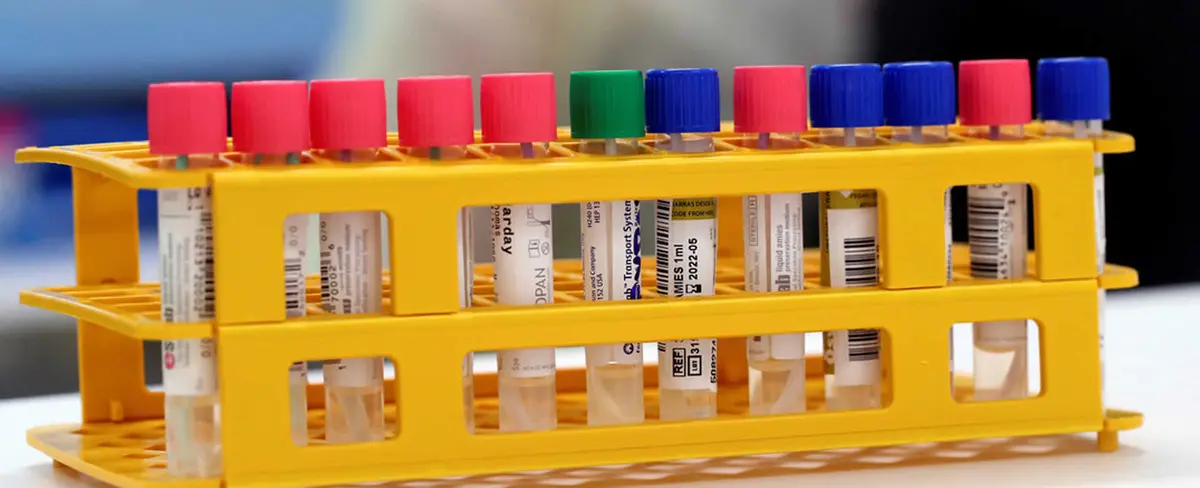 Investigaciones revelan que podrían existir cuatro tipos de pacientes con COVID-19