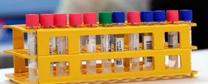 Investigaciones revelan que podrían existir cuatro tipos de pacientes con COVID-19