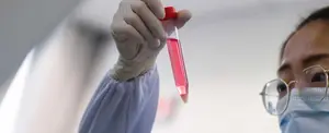 China: Científicos encuentran anticuerpos para combatir el Coronavirus
