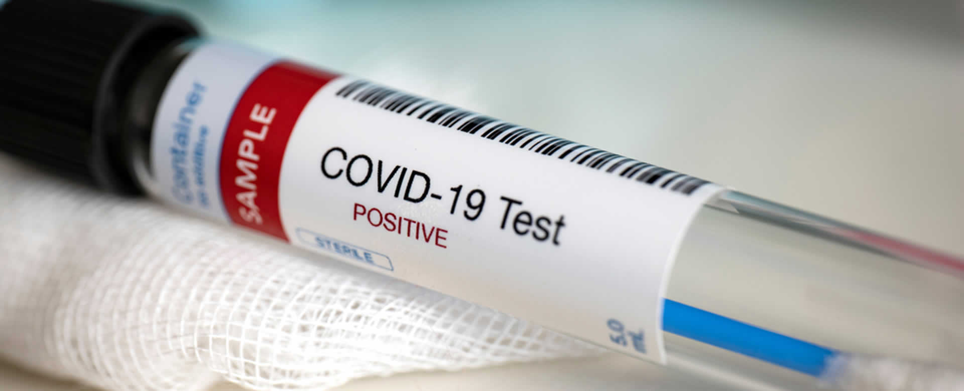 Se buscan voluntarios para infectarse de COVID-19
