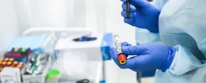 Personas sobrevivientes de SARS podrían ser inmunes a COVID-19