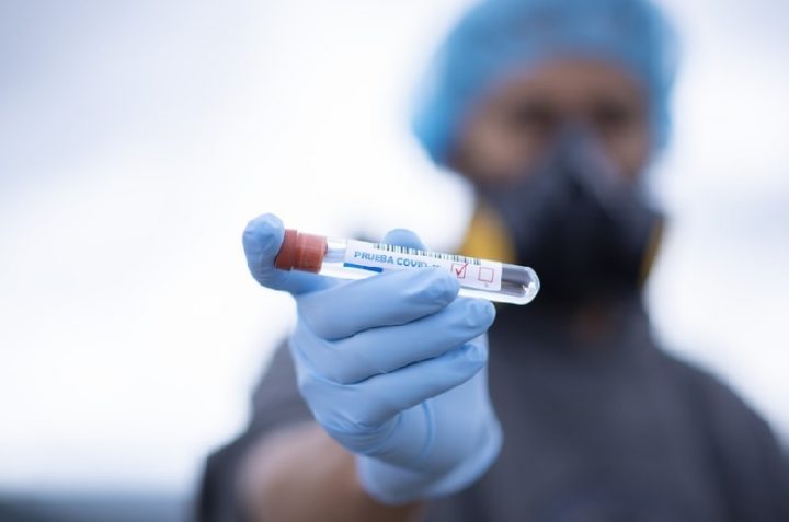 Algunos pacientes recuperados del COVID-19 podrían perder por siempre el olfato y gusto