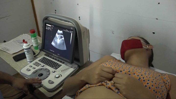 Mujer realizando examen por imagenologia.