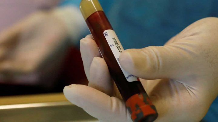 Tubos de ensayo para prueba de sangre. Tubos de ensayo para prueba de sangre.