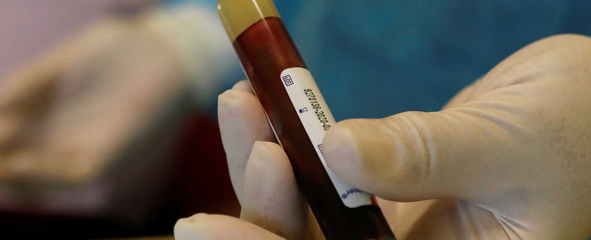 Estudio revela que el Coronavirus forma peligrosos coágulos sanguíneos mortales