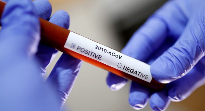 E.E.U.U supera los 5 millones de contagios y 165 mil muertes por COVID-19 