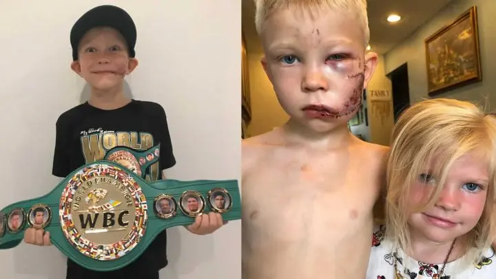 El niño que salvó a su hermanita, Bridger Walker, nombrado cómo Campeón Honorario del CMB