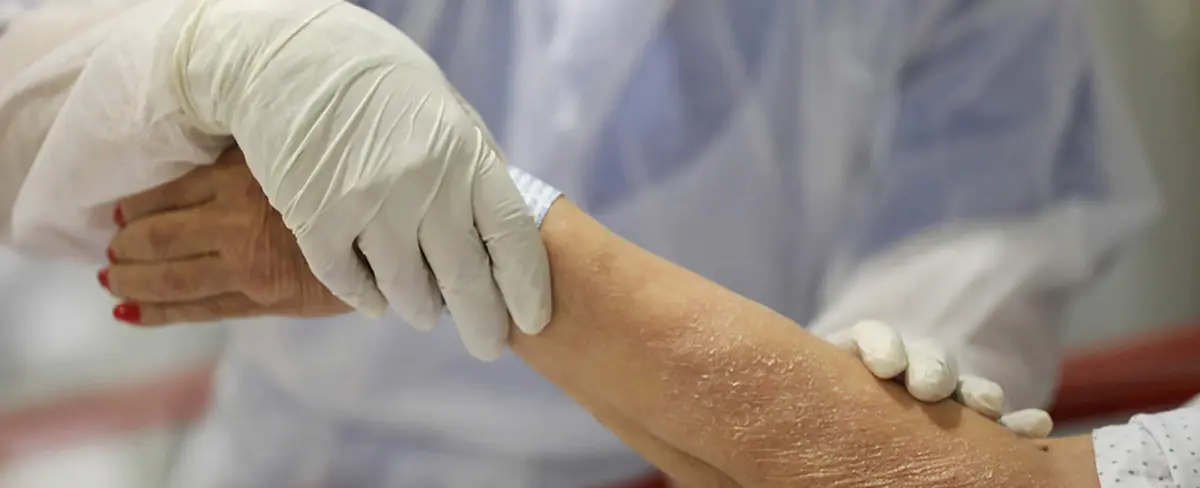 Autorizan ensayo clínico para vacuna contra el COVID-19 en España