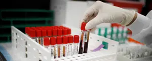 Científico que contrajo COVID asegura que no existe inmunidad colectiva