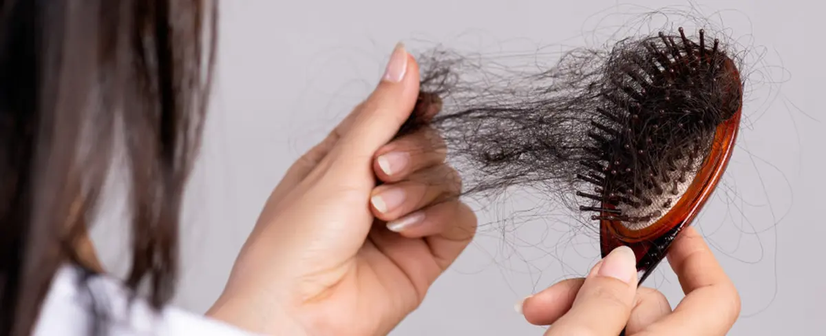 Caída de cabello por Covid-19 ¿es una secuela permanente?