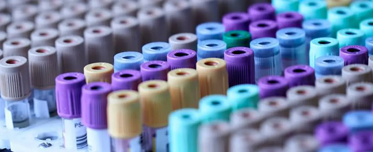 Una prueba de saliva podría ser suficiente para detectar diabetes tipo 2