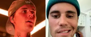 Justin Bieber revela que está batallando contra un virus que le paraliza el rostro