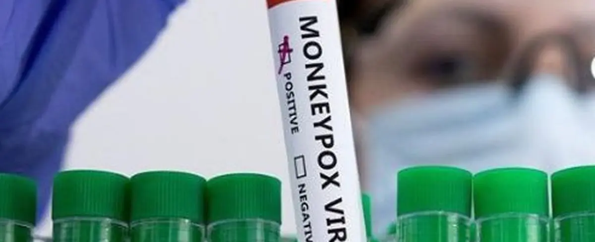 OMS registra más de 35 mil casos de la viruela del mono
