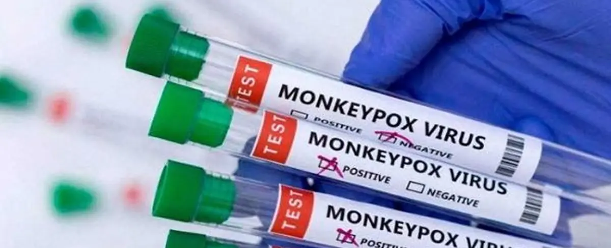 Guatemala confirma primer caso de la viruela del mono