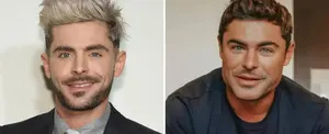 Zac Efron casi muere en accidente casero que deformó su rostro