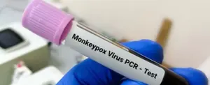 Declaran en Puerto Rico estado de emergencia por contagios de viruela símica