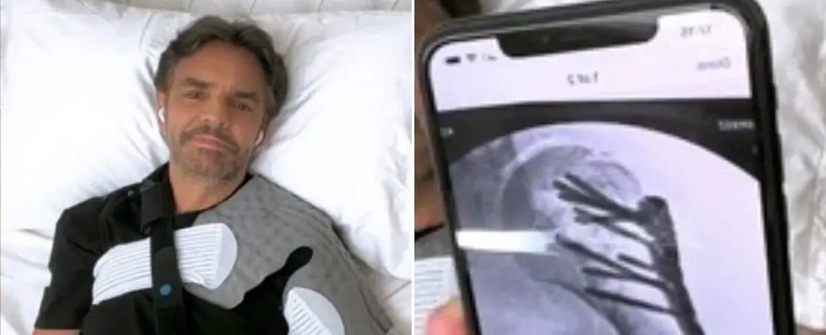 Filtran vídeo de Eugenio Derbez que muestra su recuperación
