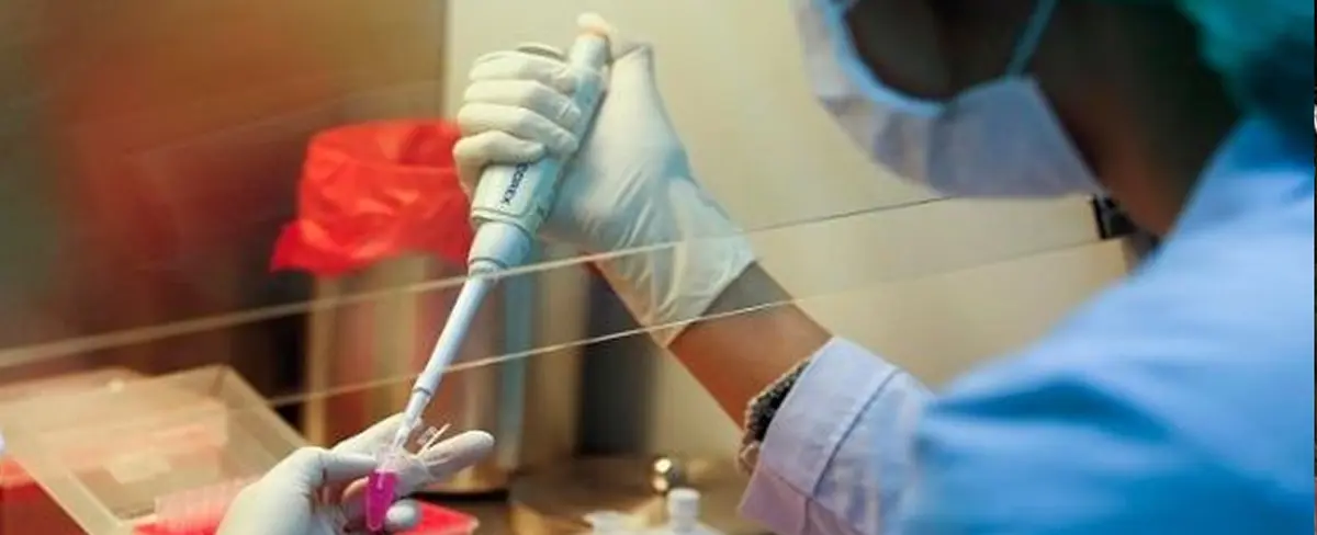México supera los 2.600 casos confirmados de viruela del mono