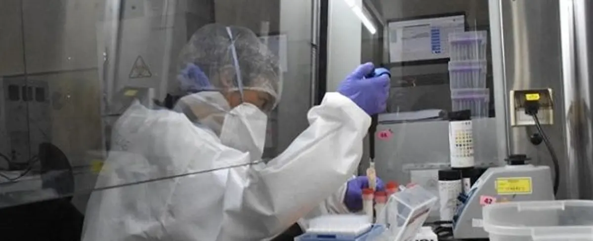 Costa Rica registra 3 nuevos casos de viruela símica