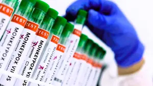 Venezuela prepara plan epidemiológico para prevenir la viruela del mono