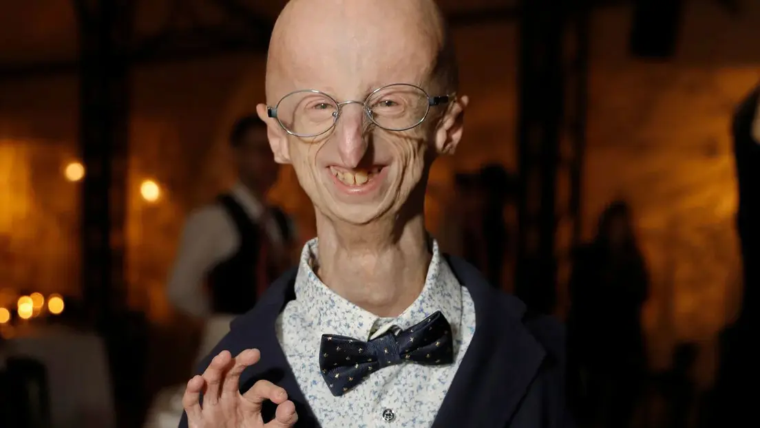 Fallece Sammy Basso, el activista con progeria más longevo del mundo