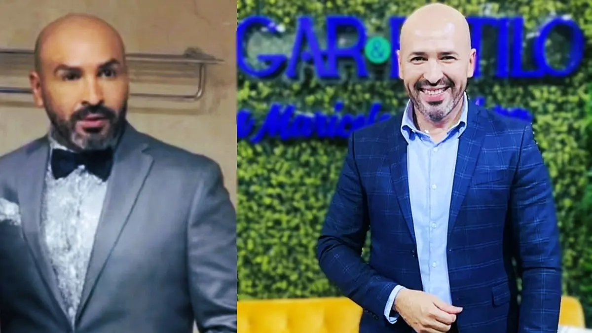 Juan Brenes está irreconocible, ¿abuso de retoques estéticos?