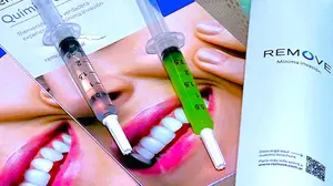 Nuevo avance dental elimina caries sin causar molestias