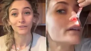 Paris Jackson revela la impactante secuela física que le dejó el abuso de drogas