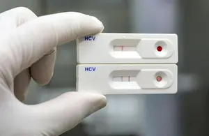 Rusia desarrolla la primera prueba rápida para detectar hepatitis C