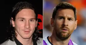 ¿El cambio físico de Messi se debe a cirugías estéticas?