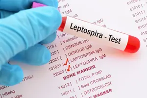 Leptospirosis: Infórmate, Prevén y Protégete